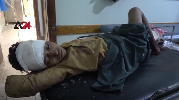 Yemen - Three children seriously injured in Houthi shelling in Taiz